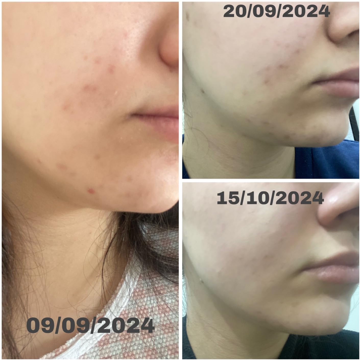 Sérum Facial 10% Niacinamida + 1% Zinco PCA (NC-10) 30ml